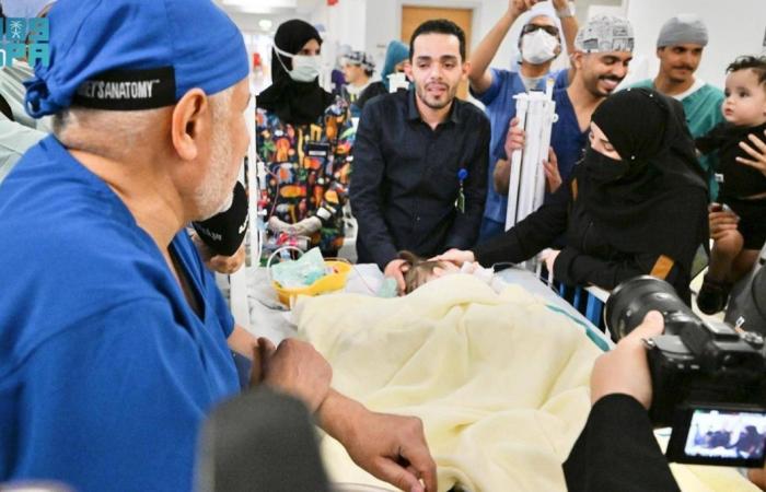 نجاح عملية فصل التوأم الملتصق السوري «سيلين وإيلين»