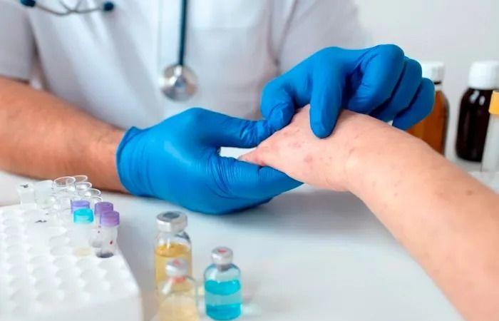 نتائج مُبشرة.. روسيا تكشف عن "لقاح جديد" لسرطان الجلد