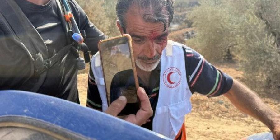 16 إصابة بينهم صحافيون ومتضامنون أجانب في اعتداءات المستوطنين وجنود الاحتلال شمال الضفة