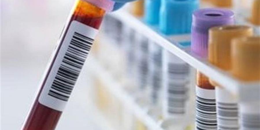 أعراض ارتفاع الصوديوم وأسبابه وطرق العلاج